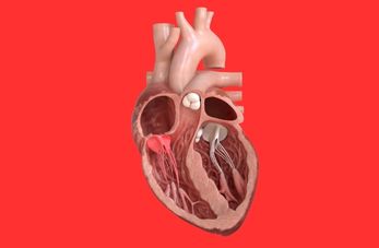 Heart Valve Disease