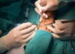Arteriovenöz Malformasyon