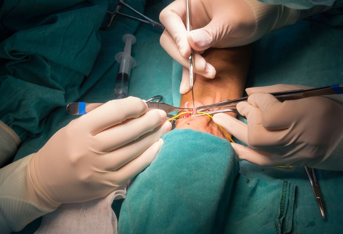 Arteriovenöz Malformasyon