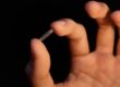 Karotis Stent İmplantasyonu