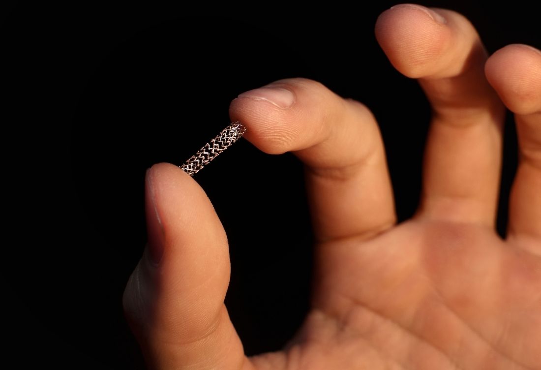 Karotis Stent İmplantasyonu