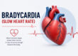 Bradycardia