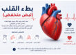 Bradycardia